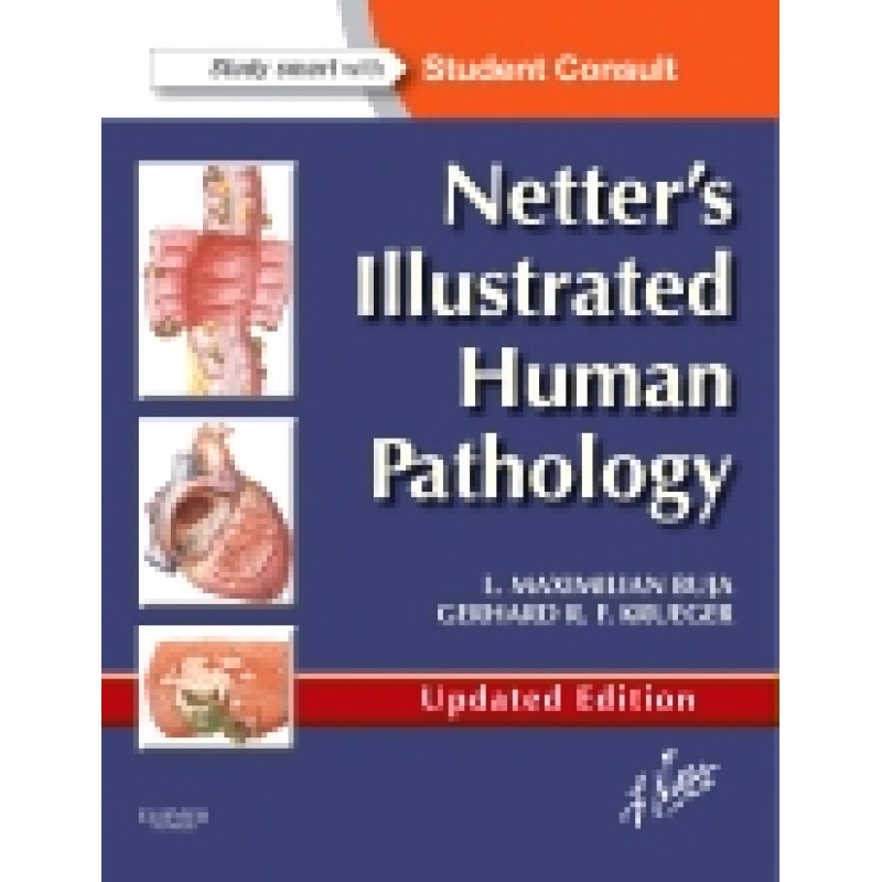 Netter's Illustrated Human Pathology Updated Edition